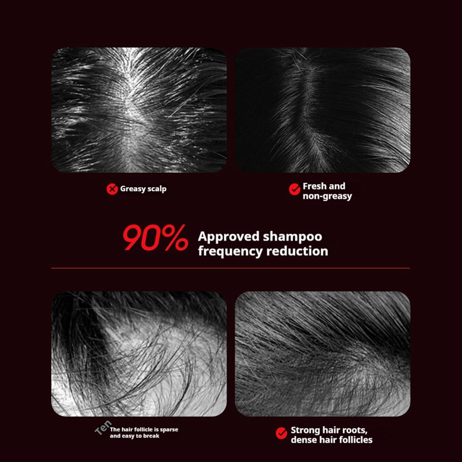 Masseur de cuir chevelu électrique avec lumière rouge et applicateur d'huile